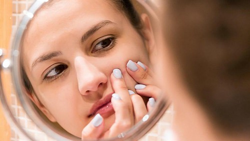 Làm thế nào khi bạn mắc bệnh “Nghiện nặn gãi da”?